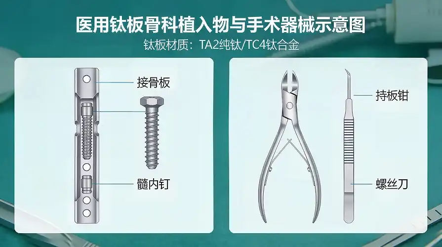 Medical Titanium Implants